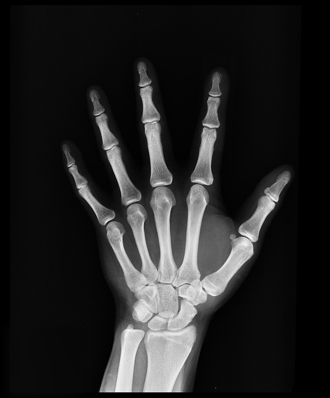 x-ray, health, arm